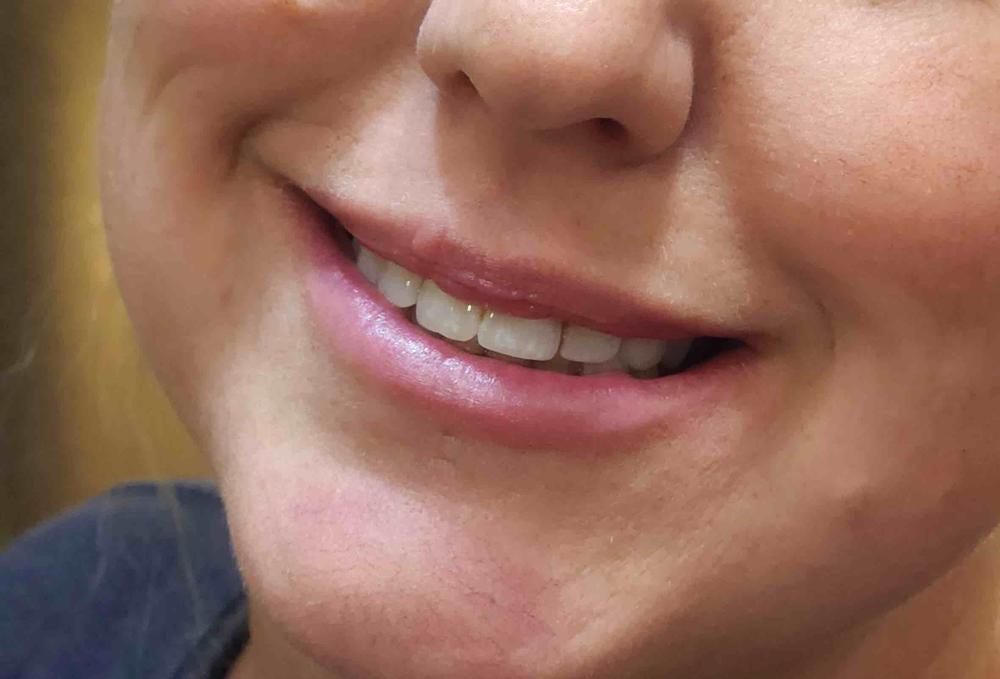 Fruit Pigmented® Lip Glaze - Customer Photo From CariJohnson